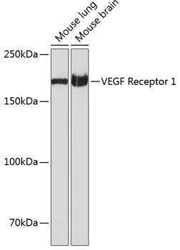 Anti-VEGFR1 Monoclonal Antibody (CAB19132)