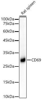 Anti-CD69 [ARC56158] Monoclonal Antibody (CAB22171)