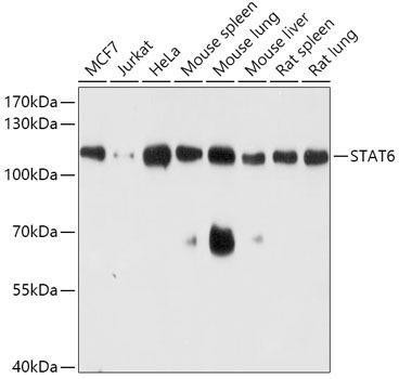 Anti-STAT6 Antibody (CAB0755)