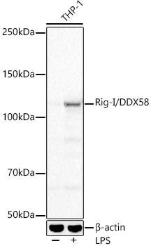 Anti-Rig-I/DDX58 [ARC54110] Monoclonal Antibody (CAB22478)