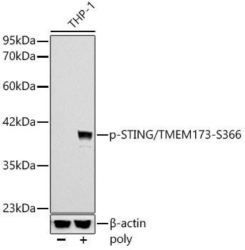Anti-Phospho-STING/TMEM173-S366 [ARC57910] Monoclonal Antibody (CABP1369)