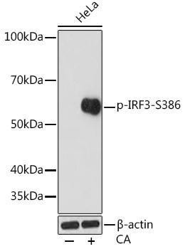Anti-Phospho-IRF3-S386 [ARC1539] Monoclonal Antibody (CABP0995)