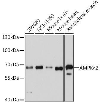 Anti-AMPKalpha2 Antibody -Knockout Validated (CAB7339)