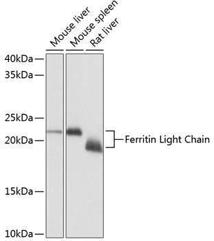 Anti-Ferritin Light Chain [ARC57605] Monoclonal Antibody (CAB11241)