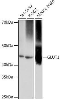Anti-GLUT1/SLC2A1 [ARC0304] Monoclonal Antibody (CAB11727)