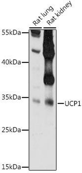 Anti-UCP1 Antibody (CAB7236)