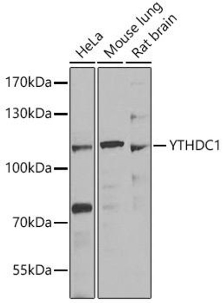 Anti-YTHDC1 Antibody (CAB7318)