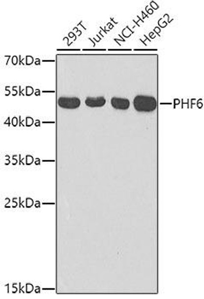 Anti-PHF6 Antibody (CAB7393)