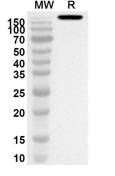 Anti-Imdevimab Polyclonal Antibody