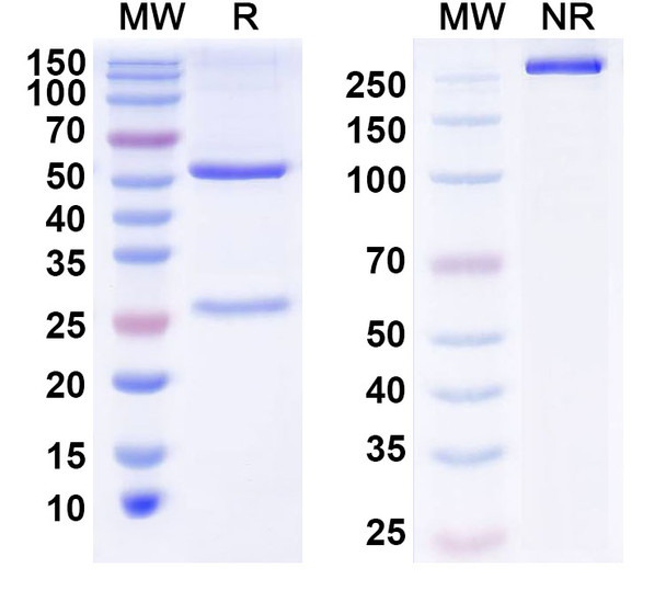 Anti-Siltuximab Non-Neutralizing Antibody [1A457]