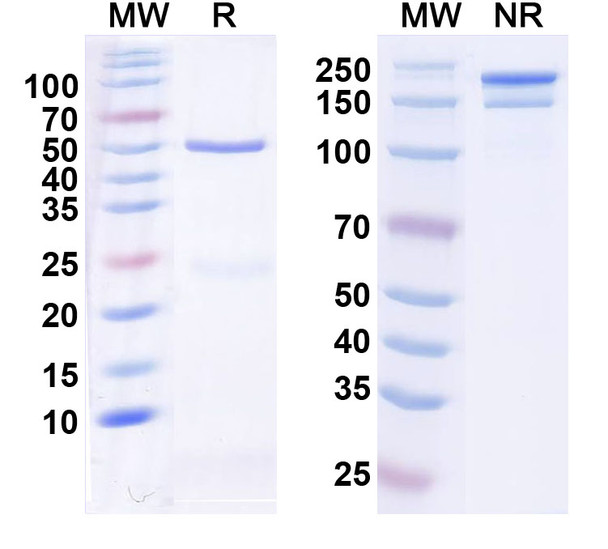 Anti-Siltuximab Neutralizing Antibody [1A456]