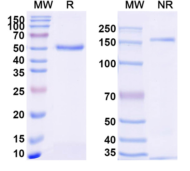 Anti-Nivolumab Neutralizing Antibody [SAA2247]