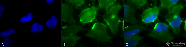 Immunocytochemistry/Immunofluorescence analysis using Mouse Anti-CD74 Monoclonal Antibody, Clone PIN 1.1 (STMA00011). Tissue: Cervical cancer cell line (HeLa). Species: Human. Fixation: 2% Formaldehyde for 20 min at RT. Primary Antibody: Mouse Anti-CD74 Monoclonal Antibody (STMA00011) at 1:100 for 12 hours at 4°C. Secondary Antibody: FITC Goat Anti-Mouse (green) at 1:200 for 2 hours at RT.
