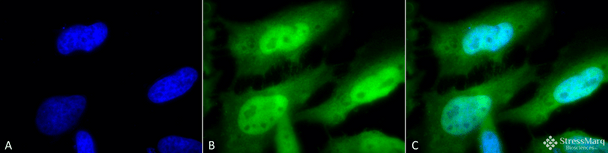 Immunocytochemistry/Immunofluorescence analysis using Rat Anti-HSF1 Monoclonal Antibody, Clone 10H8 (STMA00012). Tissue: Heat Shocked cervical cancer cells (HeLa). Species: Human. Fixation: 2% Formaldehyde for 20 min at RT. Primary Antibody: Rat Anti-HSF1 Monoclonal Antibody (STMA00012) at 1:100 for 12 hours at 4°C. Secondary Antibody: FITC Goat Anti-Rat (green) at 1:200 for 2 hours at RT.