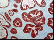 Immunohistochemistry analysis using Mouse Anti-FKBP52 Monoclonal Antibody, Clone Hi52C (STMA00022). Tissue: prostate tissue (ductal epithelial cells). Species: Human. Primary Antibody: Mouse Anti-FKBP52 Monoclonal Antibody (STMA00022) at 1:1000. Courtesy of: David F. Smith, Mayo Clinic, USA.
