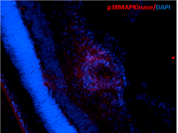 Immunohistochemistry analysis using Mouse Anti-p38 MAPK Monoclonal Antibody, Clone 9F12 (STMA00031). Tissue: Retinal Injury Model. Species: Mouse. Primary Antibody: Mouse Anti-p38 MAPK Monoclonal Antibody (STMA00031) at 1:1000. Secondary Antibody: Alexa Fluor 594 Goat Anti-Mouse (red). Courtesy of: Dr. Rajashekhar Gangaraju, University of Indiana, Department of Ophthalmology, Eugene and Marilyn Glick Eye Institute.