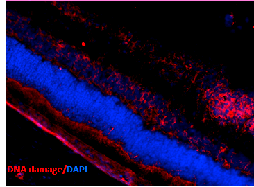 Immunohistochemistry analysis using Mouse Anti-DNA Damage Monoclonal Antibody, Clone 15A3 (STMA00034). Tissue: Retinal Injury Model. Species: Mouse. Primary Antibody: Mouse Anti-DNA Damage Monoclonal Antibody (STMA00034) at 1:1000. Secondary Antibody: Alexa Fluor 594 Goat Anti-Mouse (red). Courtesy of: Dr. Rajashekhar Gangaraju, University of Indiana, Department of Ophthalmology, Eugene and Marilyn Glick Eye Institute.