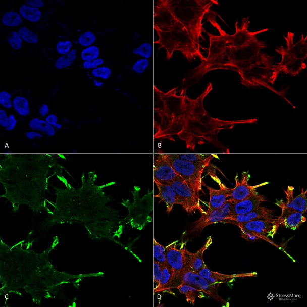 Immunocytochemistry/Immunofluorescence analysis using Mouse Anti-Alpha B Crystallin Monoclonal Antibody, Clone 1A7.D5 (STMA00035). Tissue: Neuroblastoma cell line (SK-N-BE). Species: Human. Fixation: 4% Formaldehyde for 15 min at RT. Primary Antibody: Mouse Anti-Alpha B Crystallin Monoclonal Antibody (STMA00035) at 1:100 for 60 min at RT. Secondary Antibody: Goat Anti-Mouse ATTO 488 at 1:100 for 60 min at RT.