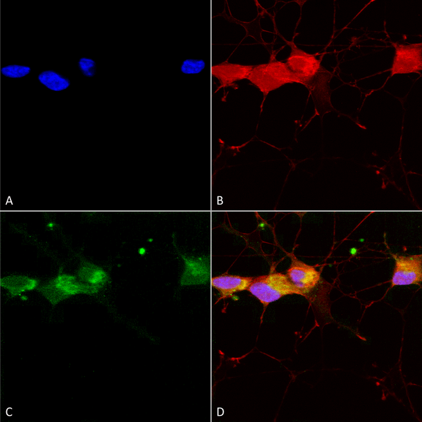 Immunocytochemistry/Immunofluorescence analysis using Mouse Anti-GluN2B Monoclonal Antibody, Clone S59-36 (STMA00098). Tissue: Neuroblastoma cells (SH-SY5Y). Species: Human. Fixation: 4% PFA for 15 min. Primary Antibody: Mouse Anti-GluN2B Monoclonal Antibody (STMA00098) at 1:50 for overnight at 4°C with slow rocking. Secondary Antibody: AlexaFluor 488 at 1:1000 for 1 hour at RT.