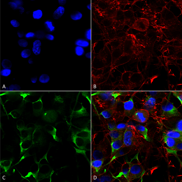 Immunocytochemistry/Immunofluorescence analysis using Mouse Anti-SNAT1 Monoclonal Antibody, Clone N104/32 (STMA00116). Tissue: Neuroblastoma cells (SH-SY5Y). Species: Human. Fixation: 4% PFA for 15 min. Primary Antibody: Mouse Anti-SNAT1 Monoclonal Antibody (STMA00116) at 1:200 for overnight at 4°C with slow rocking. Secondary Antibody: AlexaFluor 488 at 1:1000 for 1 hour at RT.