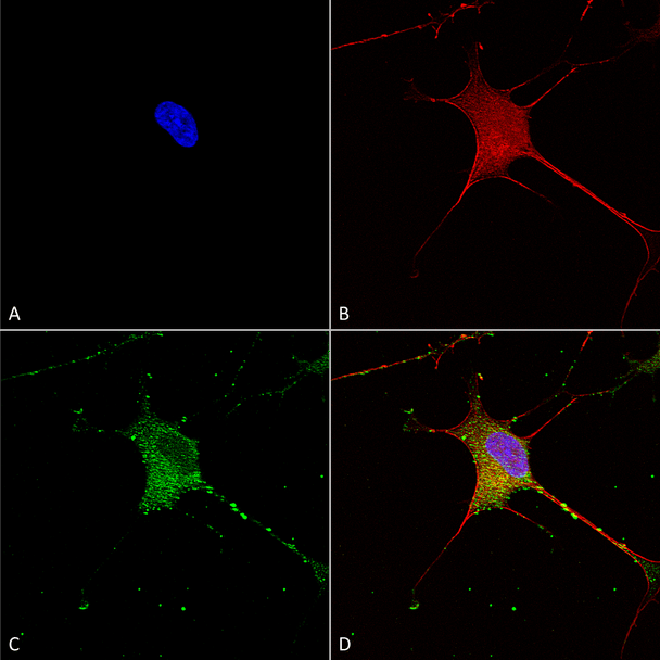 Immunocytochemistry/Immunofluorescence analysis using Mouse Anti-SUR1 Monoclonal Antibody, Clone N289/16 (STMA00123). Tissue: Neuroblastoma cells (SH-SY5Y). Species: Human. Fixation: 4% PFA for 15 min. Primary Antibody: Mouse Anti-SUR1 Monoclonal Antibody (STMA00123) at 1:50 for overnight at 4°C with slow rocking. Secondary Antibody: AlexaFluor 488 at 1:1000 for 1 hour at RT.