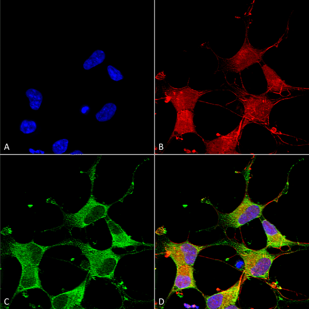 Immunocytochemistry/Immunofluorescence analysis using Mouse Anti-GIT1 Monoclonal Antibody, Clone N39B/8 (STMA00125). Tissue: Neuroblastoma cells (SH-SY5Y). Species: Human. Fixation: 4% PFA for 15 min. Primary Antibody: Mouse Anti-GIT1 Monoclonal Antibody (STMA00125) at 1:50 for overnight at 4°C with slow rocking. Secondary Antibody: AlexaFluor 488 at 1:1000 for 1 hour at RT.