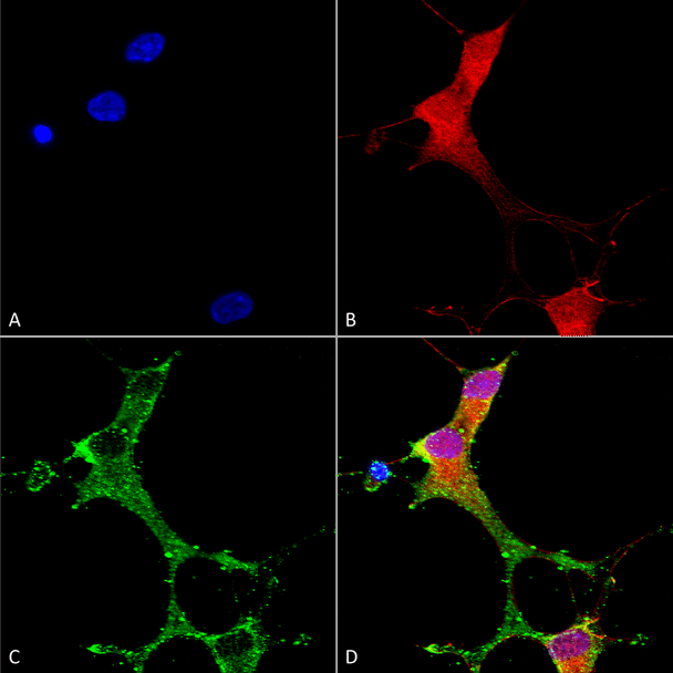 Immunocytochemistry/Immunofluorescence analysis using Mouse Anti-mGluR1/5 Monoclonal Antibody, Clone N75/3 (STMA00129). Tissue: Neuroblastoma cells (SH-SY5Y). Species: Human. Fixation: 4% PFA for 15 min. Primary Antibody: Mouse Anti-mGluR1/5 Monoclonal Antibody (STMA00129) at 1:50 for overnight at 4°C with slow rocking. Secondary Antibody: AlexaFluor 488 at 1:1000 for 1 hour at RT.