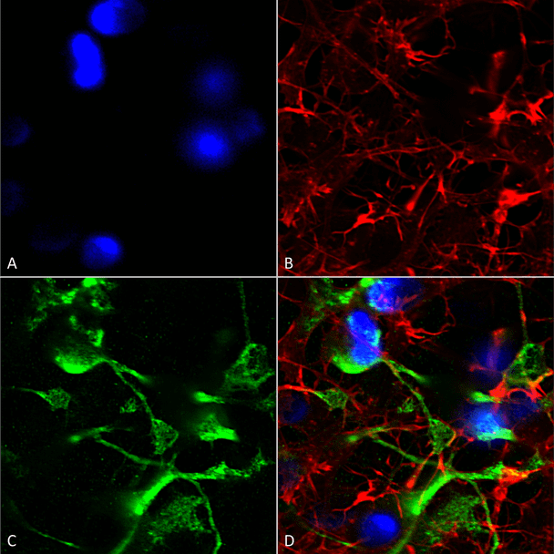 Immunocytochemistry/Immunofluorescence analysis using Mouse Anti-SUR2A Monoclonal Antibody, Clone N319A/14 (STMA00136). Tissue: Neuroblastoma cells (SH-SY5Y). Species: Human. Fixation: 4% PFA for 15 min. Primary Antibody: Mouse Anti-SUR2A Monoclonal Antibody (STMA00136) at 1:200 for overnight at 4°C with slow rocking. Secondary Antibody: AlexaFluor 488 at 1:1000 for 1 hour at RT.