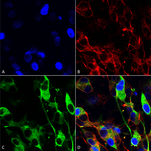 Immunocytochemistry/Immunofluorescence analysis using Mouse Anti-Versican Monoclonal Antibody, Clone N351/23 (STMA00139). Tissue: Neuroblastoma cells (SH-SY5Y). Species: Human. Fixation: 4% PFA for 15 min. Primary Antibody: Mouse Anti-Versican Monoclonal Antibody (STMA00139) at 1:200 for overnight at 4°C with slow rocking. Secondary Antibody: AlexaFluor 488 at 1:1000 for 1 hour at RT.