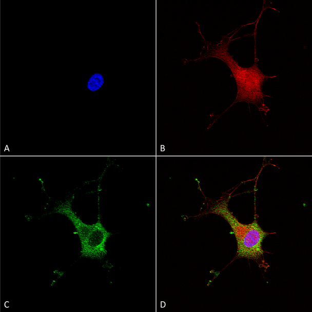 Immunocytochemistry/Immunofluorescence analysis using Mouse Anti-Alpha-2C Adrenergic Receptor Monoclonal Antibody, Clone N330A/80 (STMA00138). Tissue: Neuroblastoma cells (SH-SY5Y). Species: Human. Fixation: 4% PFA for 15 min. Primary Antibody: Mouse Anti-Alpha-2C Adrenergic Receptor Monoclonal Antibody (STMA00138) at 1:100 for overnight at 4°C with slow rocking. Secondary Antibody: AlexaFluor 488 at 1:1000 for 1 hour at RT.