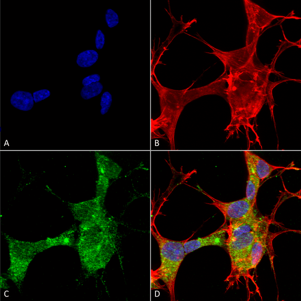 Immunocytochemistry/Immunofluorescence analysis using Mouse Anti-GFAP Monoclonal Antibody, Clone N206A/8 (STMA00141). Tissue: Neuroblastoma cells (SH-SY5Y). Species: Human. Fixation: 4% PFA for 15 min. Primary Antibody: Mouse Anti-GFAP Monoclonal Antibody (STMA00141) at 1:50 for overnight at 4°C with slow rocking. Secondary Antibody: AlexaFluor 488 at 1:1000 for 1 hour at RT.