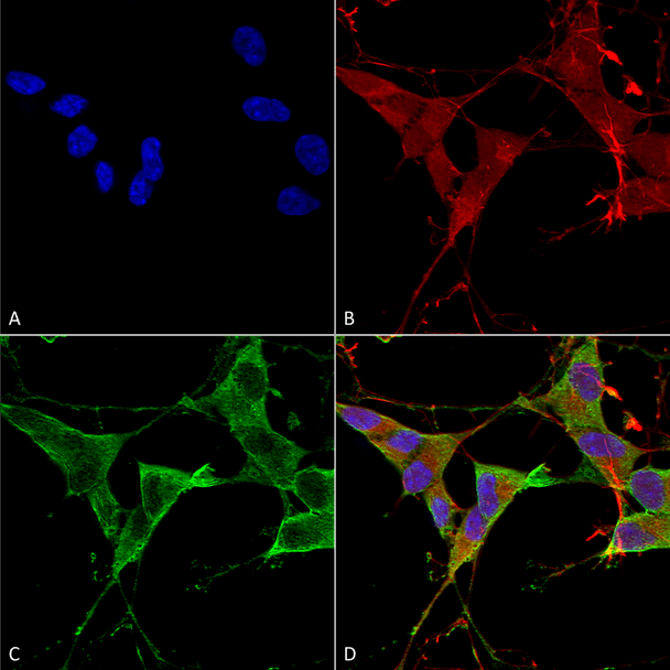 Immunocytochemistry/Immunofluorescence analysis using Mouse Anti-LAR/PTPRF Monoclonal Antibody, Clone N165/38 (STMA00143). Tissue: Neuroblastoma cells (SH-SY5Y). Species: Human. Fixation: 4% PFA for 15 min. Primary Antibody: Mouse Anti-LAR/PTPRF Monoclonal Antibody (STMA00143) at 1:100 for overnight at 4°C with slow rocking. Secondary Antibody: AlexaFluor 488 at 1:1000 for 1 hour at RT.