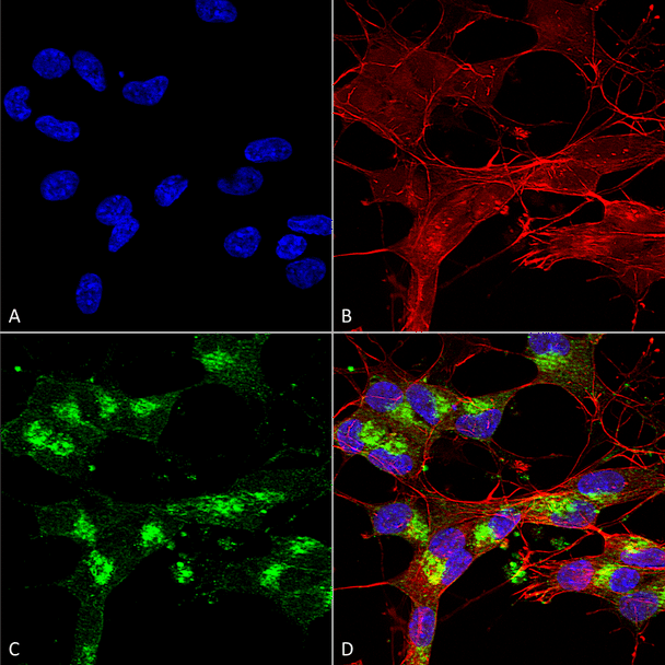Immunocytochemistry/Immunofluorescence analysis using Mouse Anti-VDAC1 Monoclonal Antibody, Clone N152B/23 (STMA00151). Tissue: Neuroblastoma cells (SH-SY5Y). Species: Human. Fixation: 4% PFA for 15 min. Primary Antibody: Mouse Anti-VDAC1 Monoclonal Antibody (STMA00151) at 1:100 for overnight at 4°C with slow rocking. Secondary Antibody: AlexaFluor 488 at 1:1000 for 1 hour at RT.