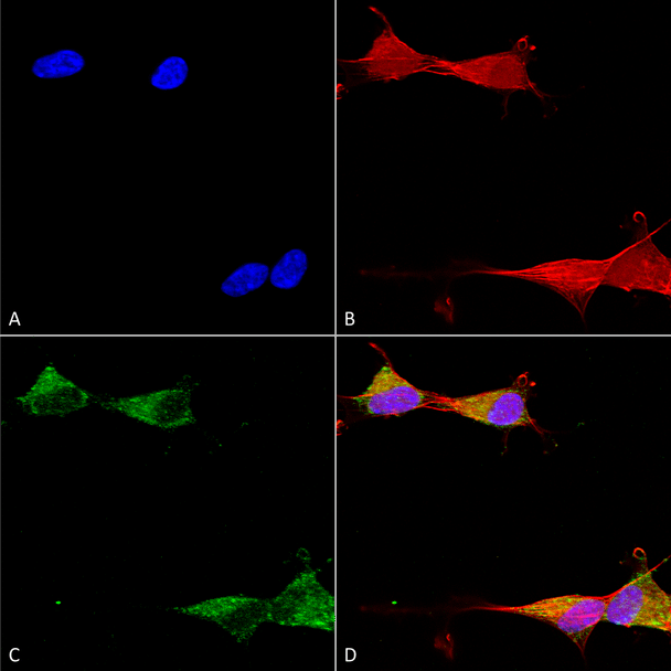 Immunocytochemistry/Immunofluorescence analysis using Mouse Anti-Ataxin 1 Monoclonal Antibody, Clone N65/37 (STMA00161). Tissue: Neuroblastoma cells (SH-SY5Y). Species: Human. Fixation: 4% PFA for 15 min. Primary Antibody: Mouse Anti-Ataxin 1 Monoclonal Antibody (STMA00161) at 1:50 for overnight at 4°C with slow rocking. Secondary Antibody: AlexaFluor 488 at 1:1000 for 1 hour at RT.
