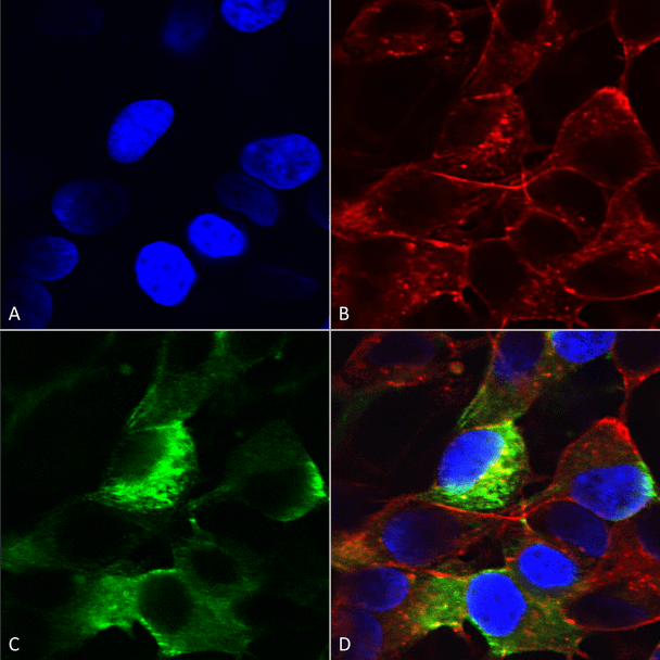 Immunocytochemistry/Immunofluorescence analysis using Mouse Anti-Nav beta3 Monoclonal Antibody, Clone N396/29 (STMA00169). Tissue: Neuroblastoma cells (SH-SY5Y). Species: Human. Fixation: 4% PFA for 15 min. Primary Antibody: Mouse Anti-Nav beta3 Monoclonal Antibody (STMA00169) at 1:200 for overnight at 4°C with slow rocking. Secondary Antibody: AlexaFluor 488 at 1:1000 for 1 hour at RT.