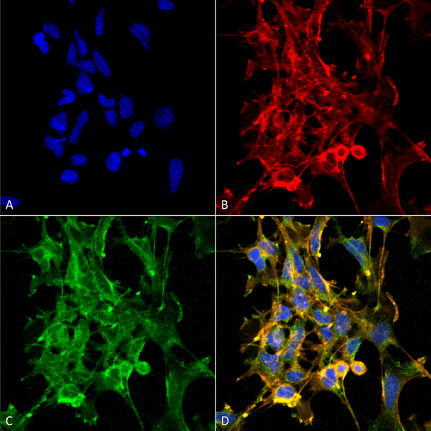 Immunocytochemistry/Immunofluorescence analysis using Mouse Anti-Citrulline Monoclonal Antibody, Clone 6C2.1 (STMA00174). Tissue: Embryonic kidney epithelial cell line (HEK293). Species: Human. Fixation: 5% Formaldehyde for 5 min. Primary Antibody: Mouse Anti-Citrulline Monoclonal Antibody (STMA00174) at 1:50 for 30-60 min at RT. Secondary Antibody: Goat Anti-Mouse Alexa Fluor 488 at 1:1500 for 30-60 min at RT.