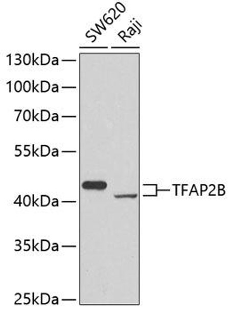 Anti-TFAP2B Antibody (CAB7935)