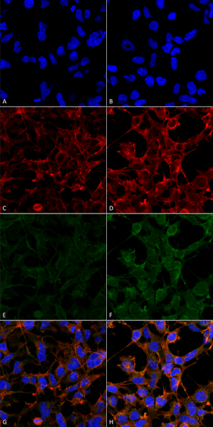 Immunocytochemistry/Immunofluorescence analysis using Mouse Anti-4-Hydroxynonenal Monoclonal Antibody, Clone 12F7 (STMA00182). Tissue: Embryonic kidney epithelial cell line (HEK293). Species: Human. Fixation: 5% Formaldehyde for 5 min. Primary Antibody: Mouse Anti-4-Hydroxynonenal Monoclonal Antibody (STMA00182) at 1:50 for 30-60 min at RT. Secondary Antibody: Goat Anti-Mouse Alexa Fluor 488 at 1:1500 for 30-60 min at RT.