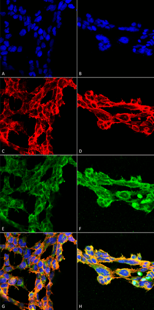 Immunocytochemistry/Immunofluorescence analysis using Mouse Anti-7-Ketocholesterol Monoclonal Antibody, Clone 7E1 (STMA00183). Tissue: Embryonic kidney epithelial cell line (HEK293). Species: Human. Fixation: 5% Formaldehyde for 5 min. Primary Antibody: Mouse Anti-7-Ketocholesterol Monoclonal Antibody (STMA00183) at 1:50 for 30-60 min at RT. Secondary Antibody: Goat Anti-Mouse Alexa Fluor 488 at 1:1500 for 30-60 min at RT.