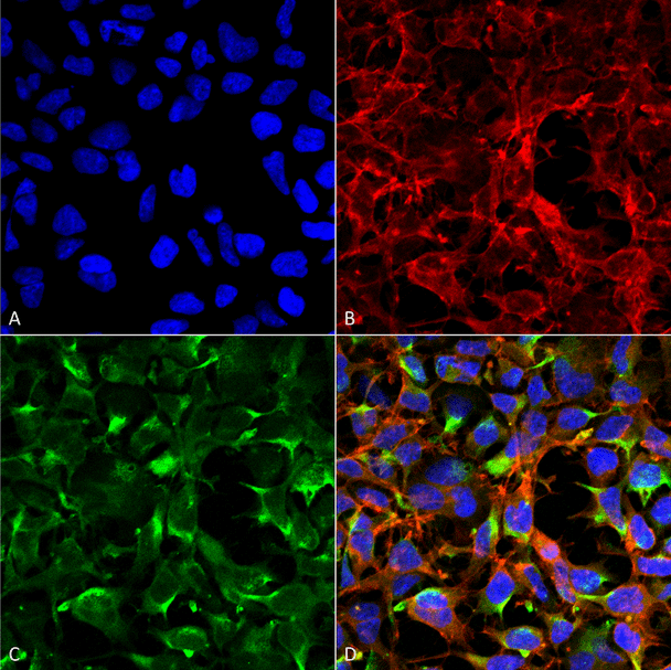 Immunocytochemistry/Immunofluorescence analysis using Mouse Anti-Dityrosine Monoclonal Antibody, Clone 7D4 (STMA00188). Tissue: Embryonic kidney cells (HEK293) cultured overnight with 50 µM H2O2. Species: Human. Fixation: 5% Formaldehyde for 5 min. Primary Antibody: Mouse Anti-Dityrosine Monoclonal Antibody (STMA00188) at 1:50 for 30-60 min at RT. Secondary Antibody: Goat Anti-Mouse Alexa Fluor 488 at 1:1500 for 30-60 min at RT.