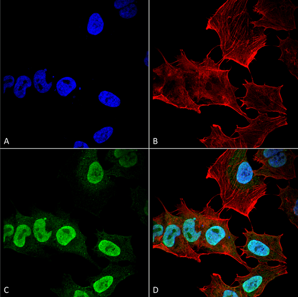 Immunocytochemistry/Immunofluorescence analysis using Mouse Anti-Alpha Synuclein Monoclonal Antibody, Clone 10H7 (STMA00192). Tissue: Neuroblastoma cell line (SK-N-BE). Species: Human. Fixation: 4% Formaldehyde for 15 min at RT. Primary Antibody: Mouse Anti-Alpha Synuclein Monoclonal Antibody (STMA00192) at 1:100 for 60 min at RT. Secondary Antibody: Goat Anti-Mouse ATTO 488 at 1:200 for 60 min at RT.