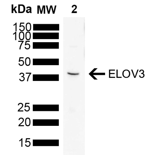 Western Blot analysis of Rat brain showing detection of 31.5 kDa ELOVL3 protein using Mouse Anti-ELOVL3 Monoclonal Antibody, Clone V61P2B3-D10 (STMA00203). Load: 10 µg. Block: 5% Skim Milk powder in TBST. Primary Antibody: Mouse Anti-ELOVL3 Monoclonal Antibody (STMA00203) at 1:1000 for 2 hours at RT with shaking. Secondary Antibody: Goat anti-mouse IgG:HRP at 1:5000 for 1 hour at RT with shaking.