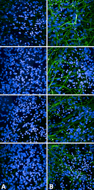 Immunocytochemistry/Immunofluorescence analysis using Rabbit Anti-Tau Monoclonal Antibody, Clone AH36 (STMA00207). Tissue: iPSC-derived cortical excitatory neurons. Species: Human. Primary Antibody: Rabbit Anti-Tau Monoclonal Antibody (STMA00207) at 1:500 for Overnight. Secondary Antibody: Donkey anti-rabbit: Alexa Fluor 488 at 1:1000. Counterstain: DAPI. A) iPSC-derived neurons from non-demented control (NDC).