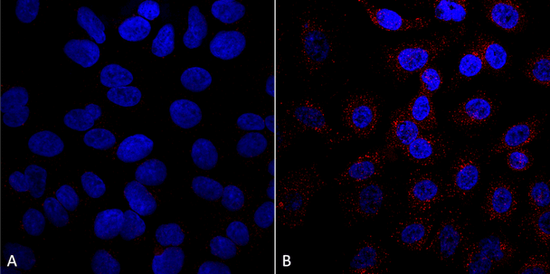 Immunocytochemistry/Immunofluorescence analysis using Mouse Anti-VPS35 Monoclonal Antibody, Clone 5A9 (STMA00209). Tissue: A549 cells. Species: Human. Primary Antibody: Mouse Anti-VPS35 Monoclonal Antibody (STMA00209) at 1:5 (tissue culture supernatant). Secondary Antibody: Donkey anti-mouse: Alexa Fluor 594 at 1:4000 in 0.2% BSA PBS. Counterstain: DAPI. Localization: Vesicles. A) VPS35 KO A549 cells B) WT A549 cells.