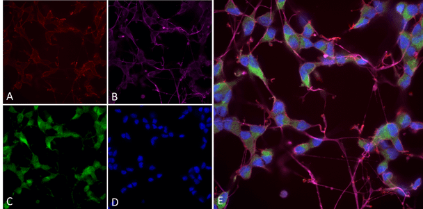 Immunocytochemistry/Immunofluorescence analysis using Mouse Anti-NOS1/ nNos Monoclonal Antibody, Clone J23 (STMA00215). Tissue: Differentiated SH-SY5Y. Species: Human. Primary Antibody: Mouse Anti-NOS1/ nNos Monoclonal Antibody (STMA00215) at 1:250. Secondary Antibody: AlexaFluor 488. Counterstain: phalloidin (Alexa 647, red), beta tubulin (Anti-beta III Tubulin Ab, Alexa 555, magenta) Hoechst (blue). (A) Phalloidin (B) Anti-beta III Tubulin Ab.