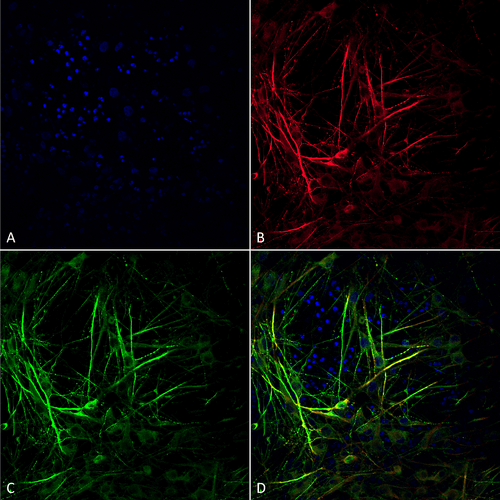 Immunocytochemistry/Immunofluorescence analysis using Mouse Anti-Tau Monoclonal Antibody, Clone 3D4 (STMA00214). Tissue: iPSC-derived neurons. Species: Human. Fixation: 4% PFA. Primary Antibody: Mouse Anti-Tau Monoclonal Antibody (STMA00214) at 1:100 for Overnight at 4°C. Counterstain: DAPI at 1:5000 for 5 minutes at RT in the dark. Magnification: 40X. Courtesy of: Francesco Paonessa.