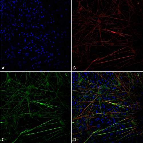 Immunocytochemistry/Immunofluorescence analysis using Mouse Anti-Tau Monoclonal Antibody, Clone 1D5 (STMA00213). Tissue: iPSC-derived neurons. Species: Human. Fixation: 4% PFA. Primary Antibody: Mouse Anti-Tau Monoclonal Antibody (STMA00213) at 1:100 for Overnight at 4°C. Counterstain: DAPI at 1:5000 for 5 minutes at RT in the dark. Magnification: 40X. Courtesy of: Francesco Paonessa.