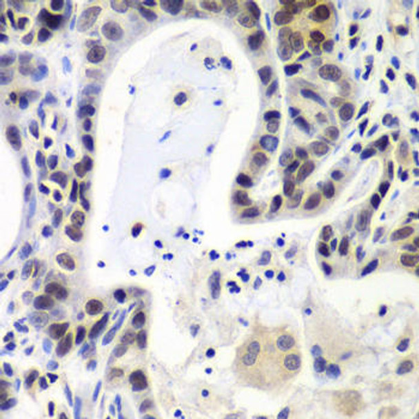 Anti-LSM2 Antibody (CAB7988)