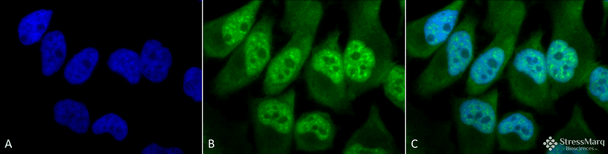 Immunocytochemistry/Immunofluorescence analysis using Rabbit Anti-Phosphothreonine Polyclonal Antibody (STPA00022). Tissue: Cervical cancer cell line (HeLa). Species: Human. Fixation: 2% Formaldehyde for 20 min at RT. Primary Antibody: Rabbit Anti-Phosphothreonine Polyclonal Antibody (STPA00022) at 1:60 for 12 hours at 4°C. Secondary Antibody: FITC Goat Anti-Rabbit (green) at 1:200 for 2 hours at RT.
