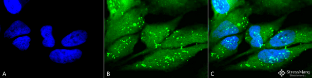 Immunocytochemistry/Immunofluorescence analysis using Rabbit Anti-p38 Polyclonal Antibody (STPA00027). Tissue: Cervical cancer cell line (HeLa). Species: Human. Fixation: 2% Formaldehyde for 20 min at RT. Primary Antibody: Rabbit Anti-p38 Polyclonal Antibody (STPA00027) at 1:100 for 12 hours at 4°C. Secondary Antibody: FITC Goat Anti-Rabbit (green) at 1:200 for 2 hours at RT. Counterstain: DAPI (blue) nuclear stain at 1:40000 for 2 hours at RT.